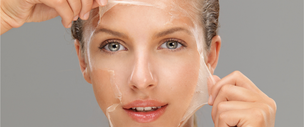 Chemical Peel
