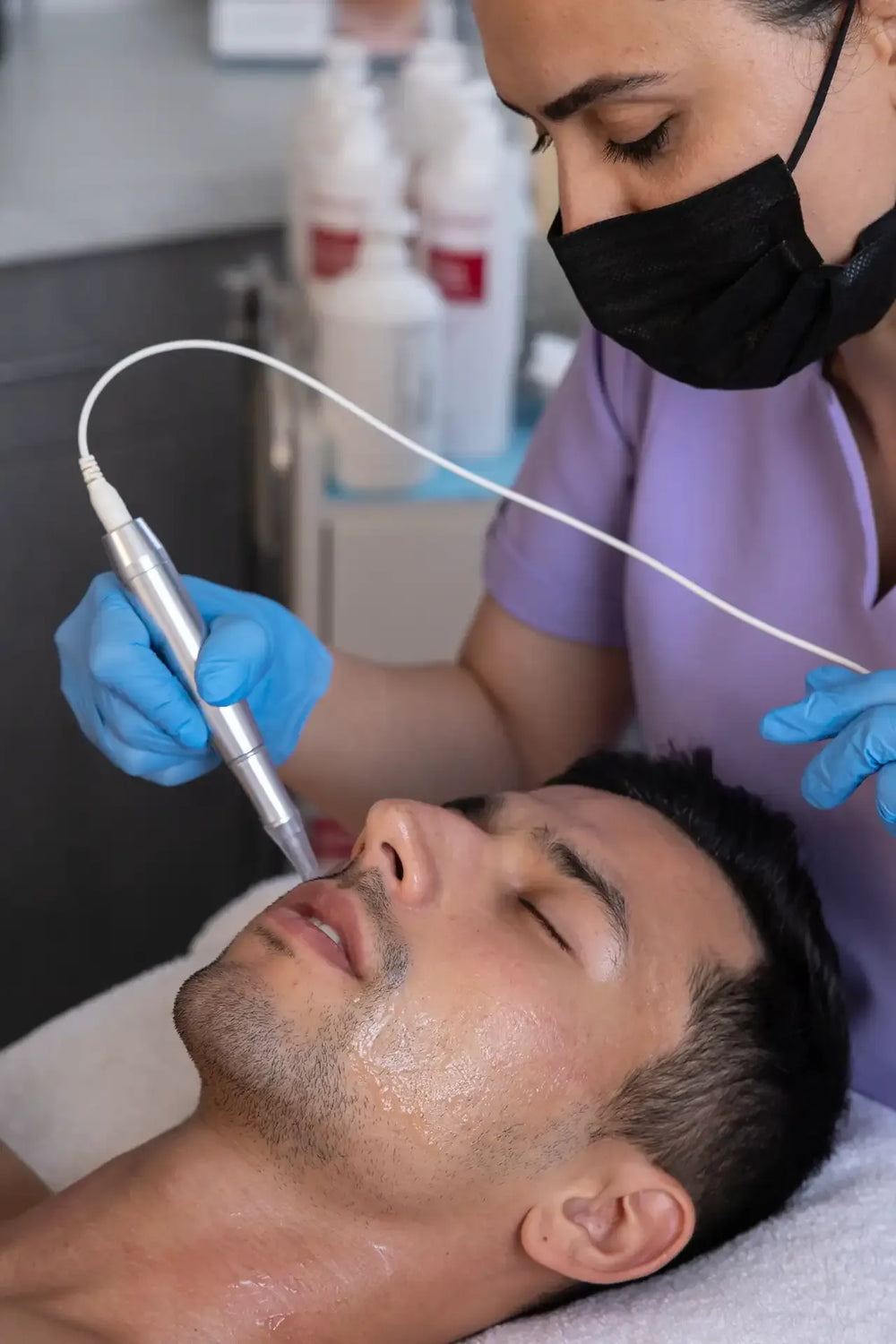 Microneedling treatment performed on a woman's face at OC Skin Care Center medical aesthetics practice