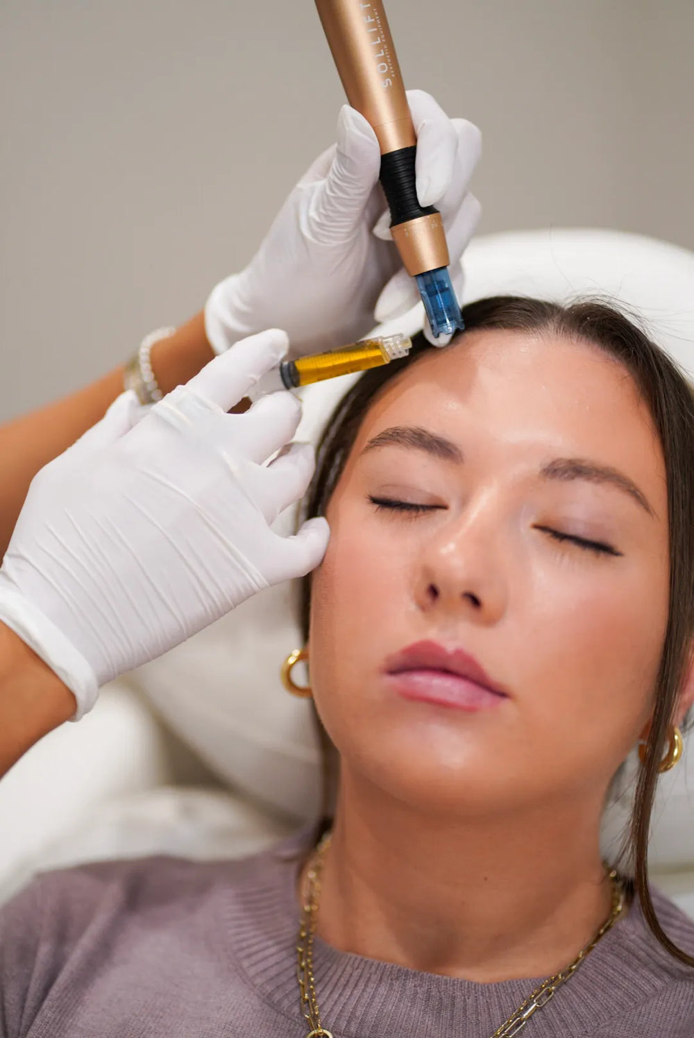 Microneedling with exosomes treatment at OC Skin Care Center in Newport Beach, California.